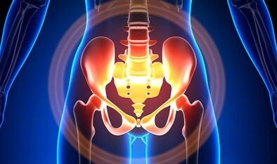 The causes of varicose veins of the pelvis