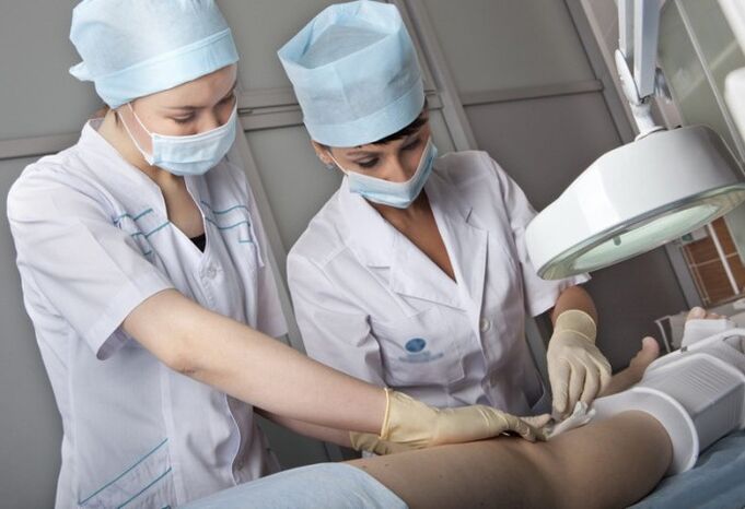 Performing surgery for varicose veins on the legs