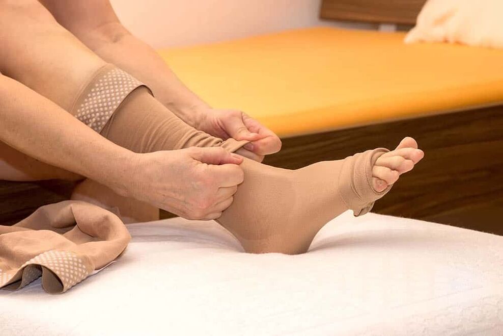 The use of compression hosiery will help ease the manifestations of varicose veins. 